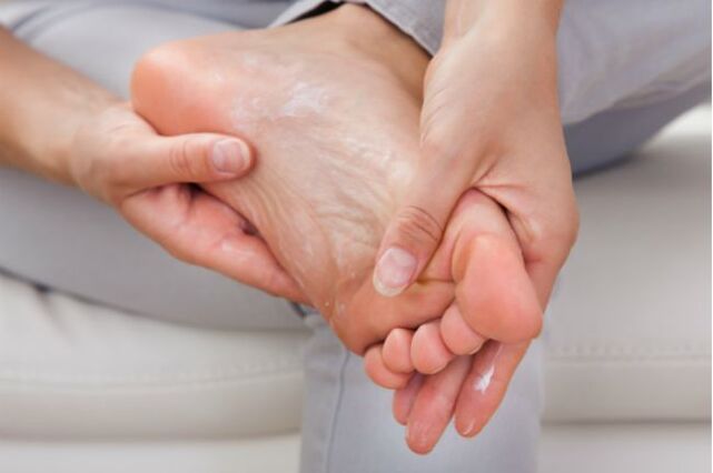 Antifungal creams and drops will help in the early stages of toenail fungus. 