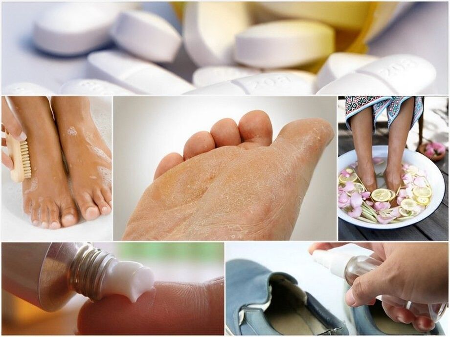 prevent fungal nail infections
