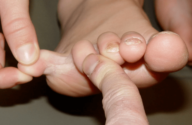 Mushroom between the fingers