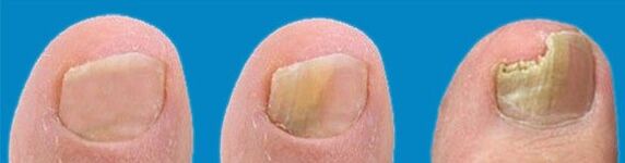 Mushroom development process