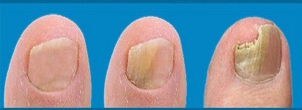 fungal development process